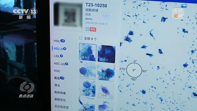 焦点访谈丨辅助诊断、AI问答、健康管理……AI正重塑医疗服务链条